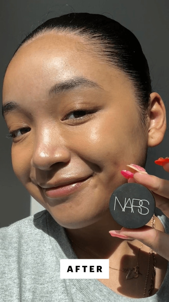 Richards after applying the Nars Soft Matte Concealer